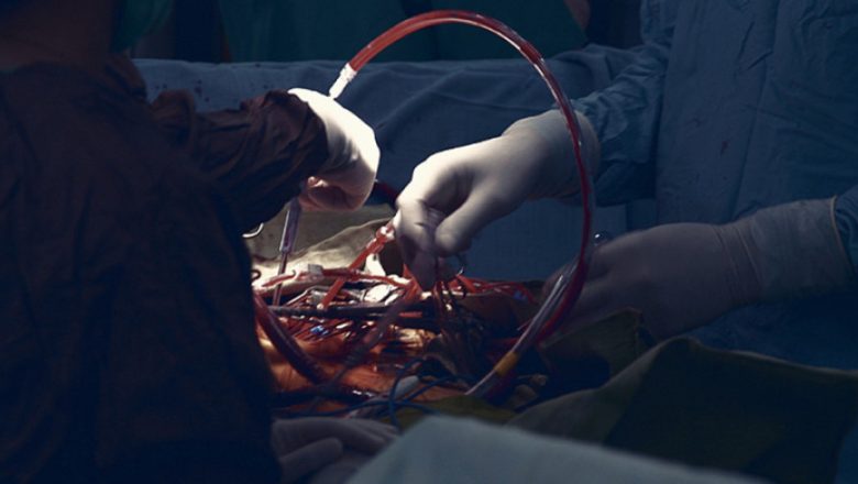 पूर्वाधार र अस्पतालको क्षमता नहुँदा नेपालमा अंग प्रत्यारोपण कठिन